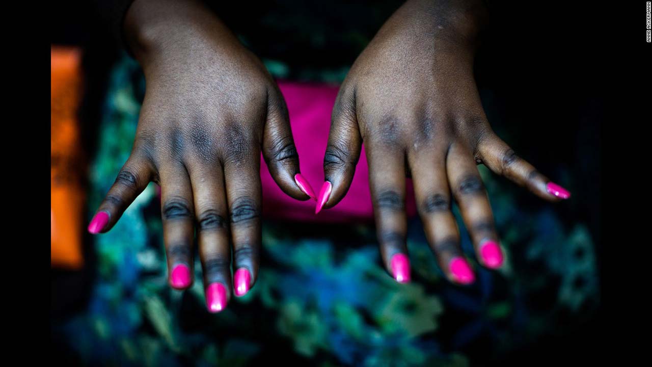 Rwandan Government Bans Skin Bleaching Products Rwandan Government Bans Skin Bleaching ProductsGuardian Life