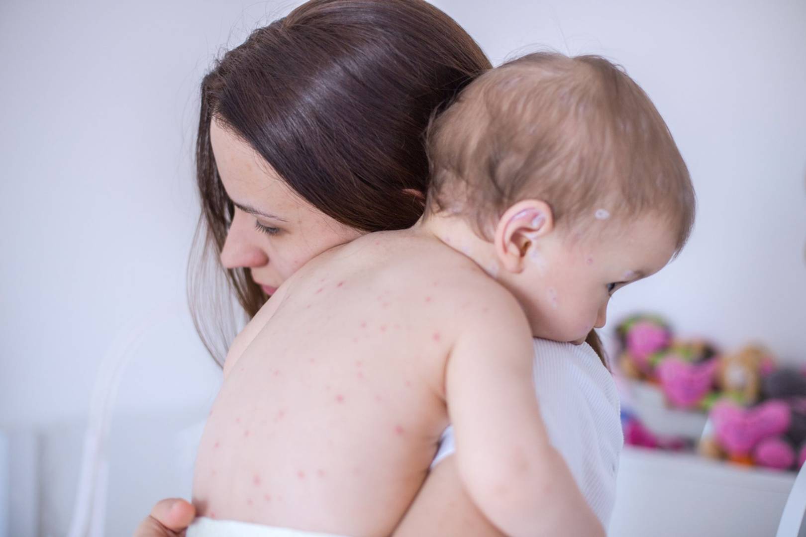 Kiev reports first measles death as cases soar Kiev reports first measles death as cases soar The Guardian Nigeria News