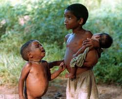 Undernourished