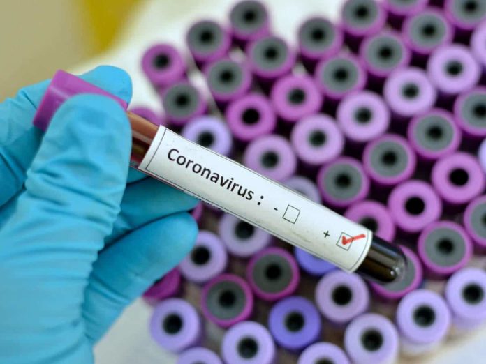 Coronavirus (1)