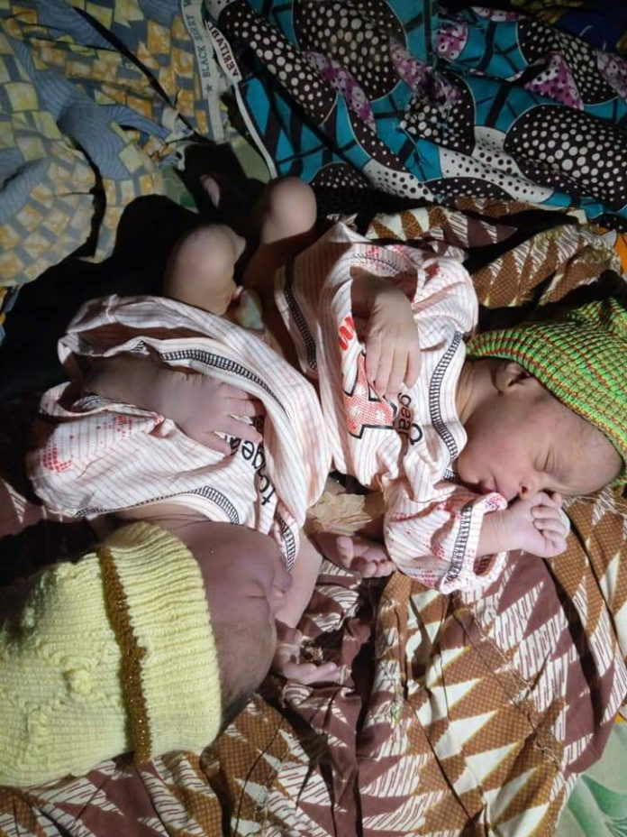 woman-gives-birth-to-conjoined-twins-in-kaduna-1