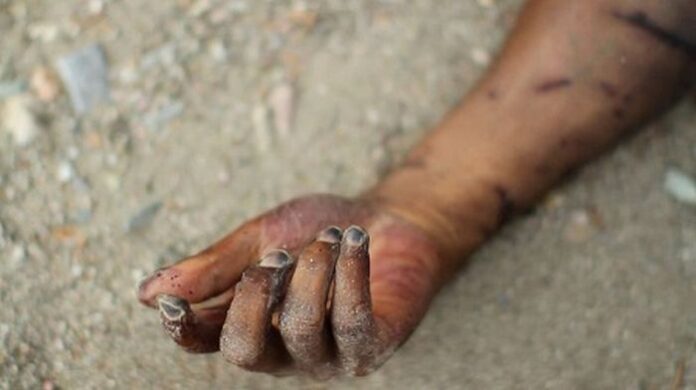 Dead-hand1