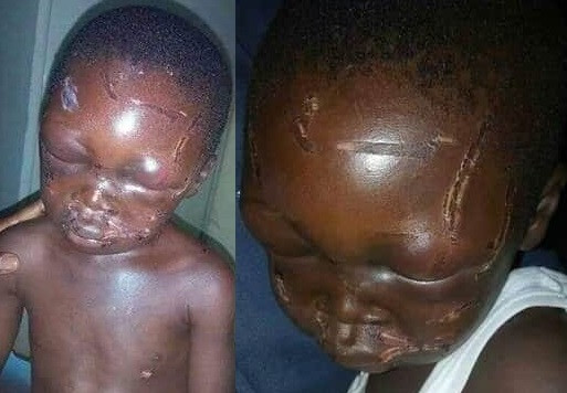 boy battered