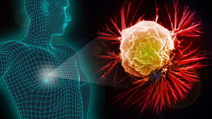male-breast-cancer-