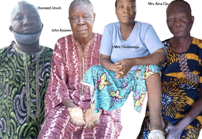 Inmates-of-Lepers-Colony-Abeokuta