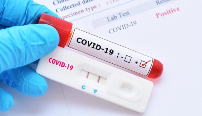 covid-test-2-1140x684-1