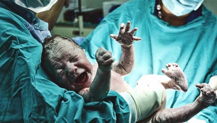 766x415_Placenta_Delivery_What_to_Expect-732x415