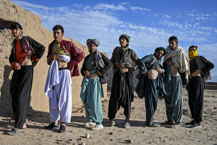 AFGHANISTAN-ECONOMY-HEALTH-ORGANS